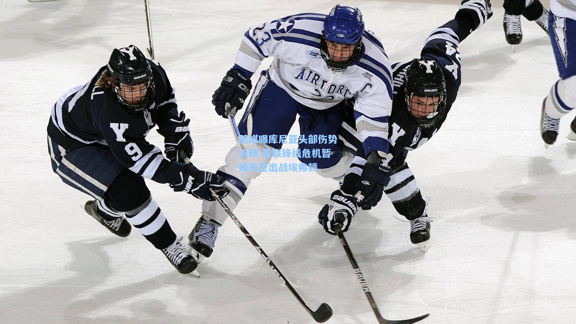 英媒曝库尼亚头部伤势无碍 曼联锋线危机暂缓有望出战埃弗顿